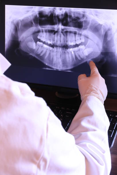 Best Broken or Cracked Tooth Emergency Dentist in Princeton, MO